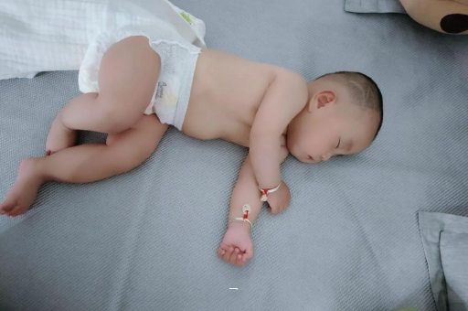 香河宝宝脸上有白色斑块